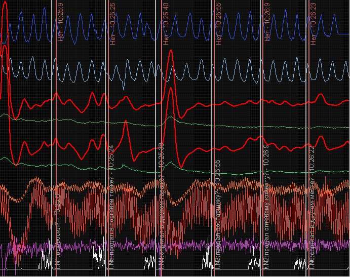 Перевірка на поліграфі Дніпро (Невірність та Зрада)