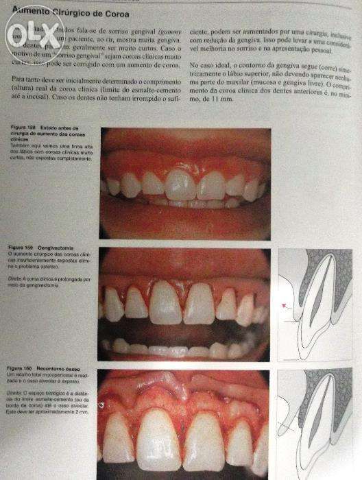 Odontologia Estetica-Atlas colorido