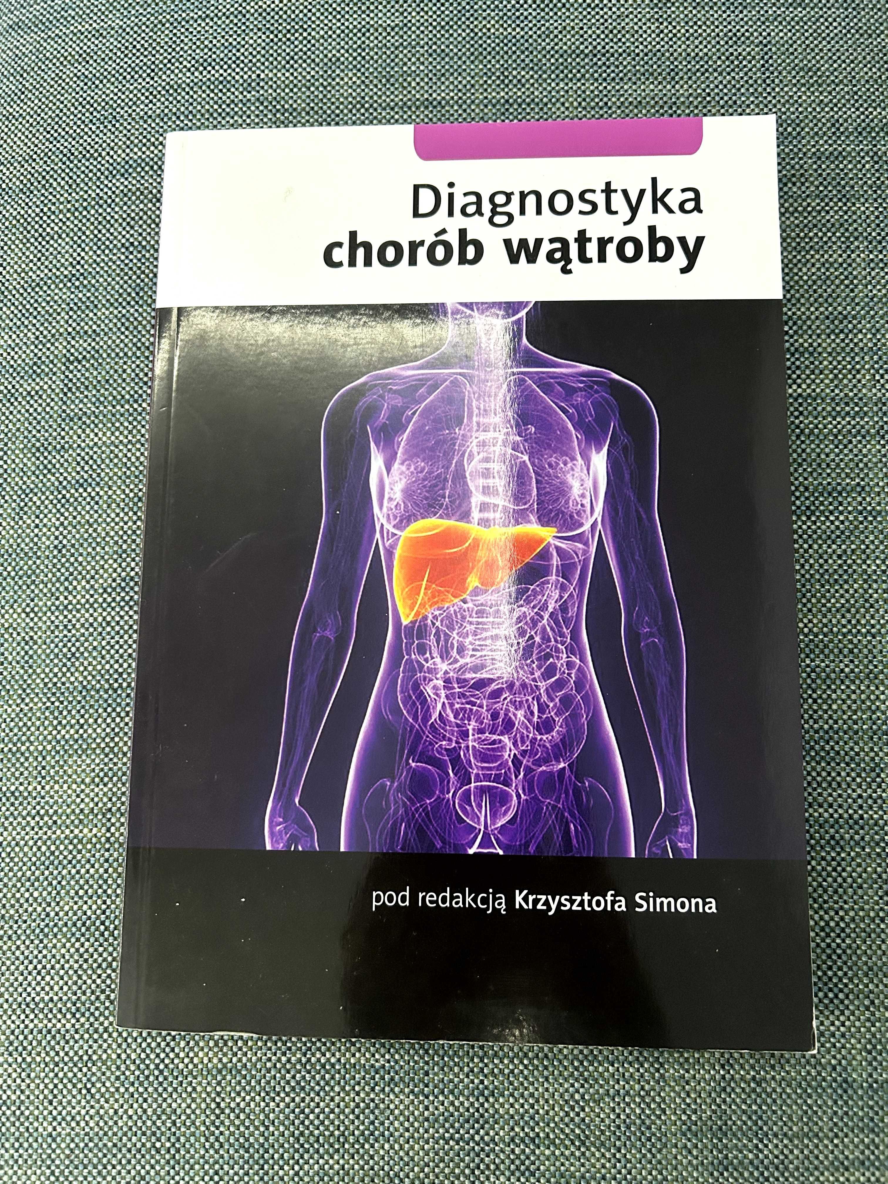 Diagnostyka chorób wątroby Krzysztof Simon