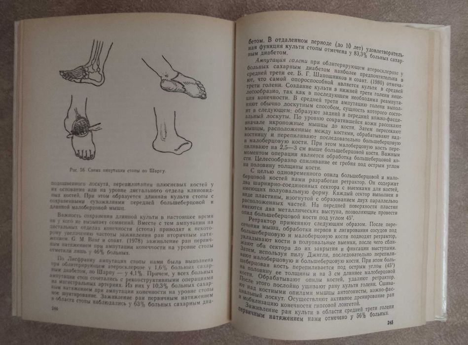 "Хирургия атеросклероза сосудов у больных сахарным диабетом"