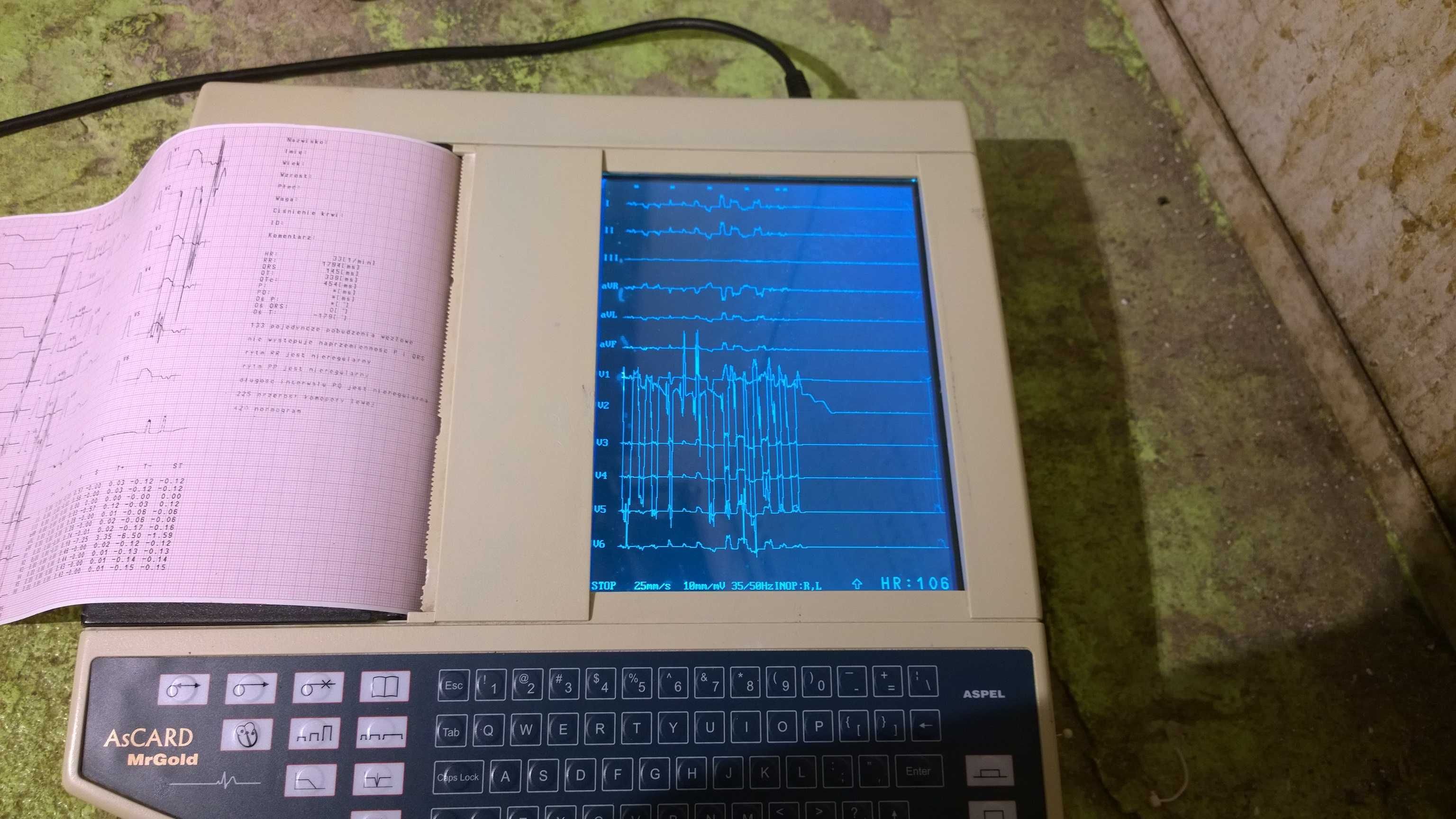 EKG - Elektrokardiograf