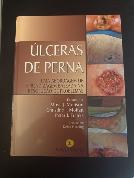 Livro Ulceras de Perna