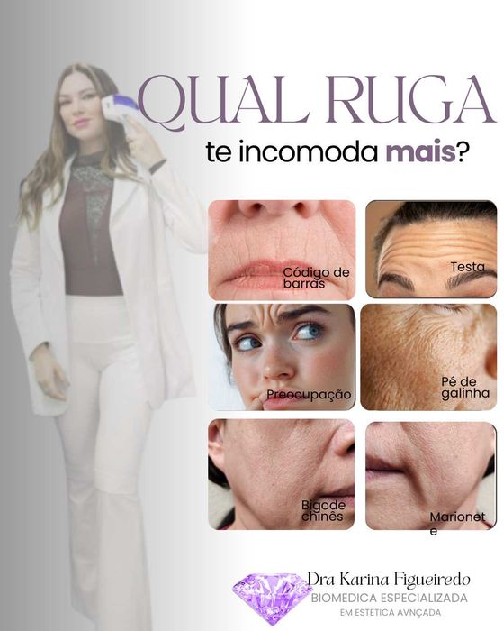 Remoçao de pigmentos a Laser