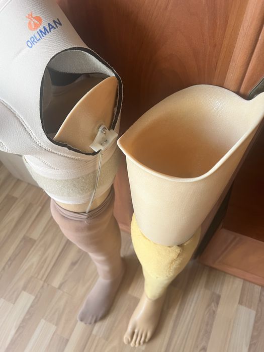 Протез лівої ноги