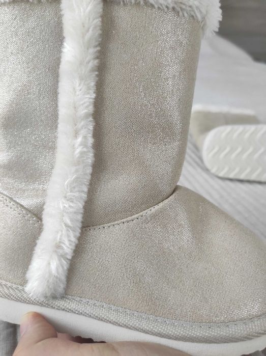 Уги на дівчинку.