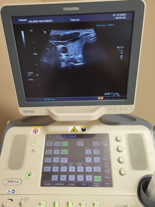 Ultrasonograf aparat USG Toshiba Xario 660a