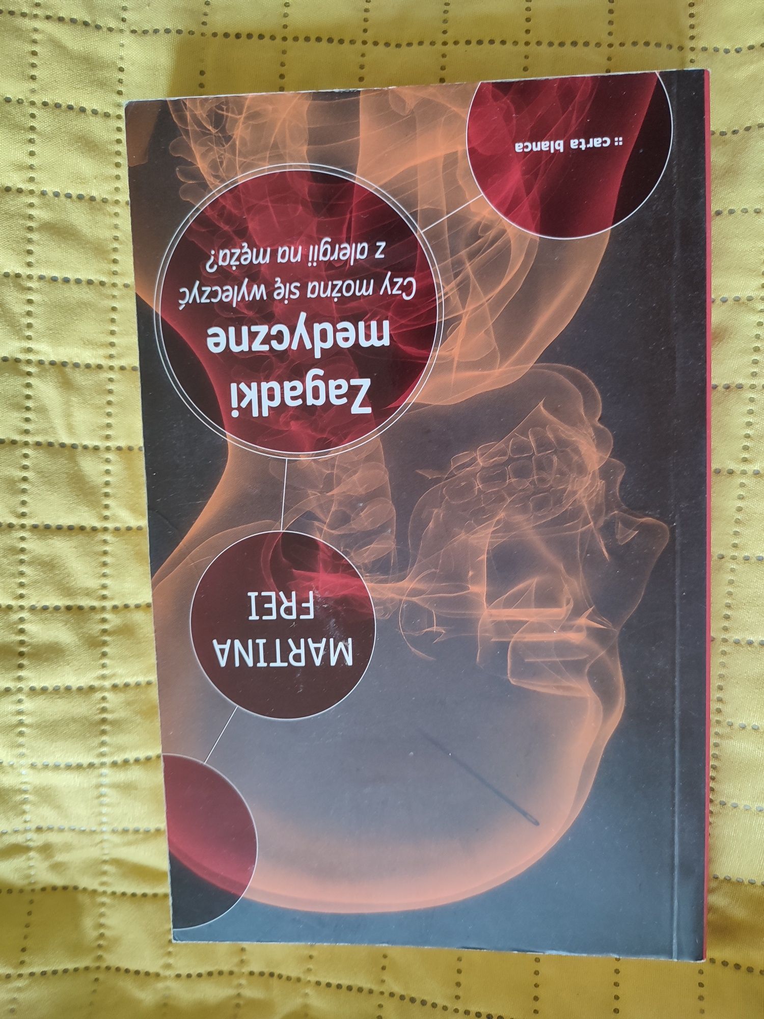 Zagadki medyczne. Czy można wyleczyć się z alergii na męża?