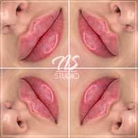 Medycyna estetyczna Powiększanie ust Wolumetria Botoks mezoterapia