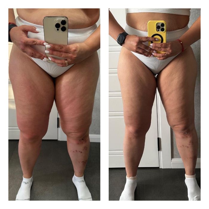 Массаж в Черноморске