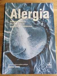 Alergia T. Holgate