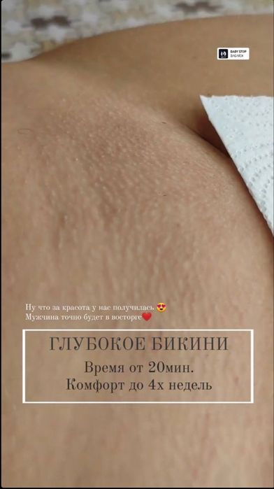 Депіляція (Піски) Депиляция воском(Пески)