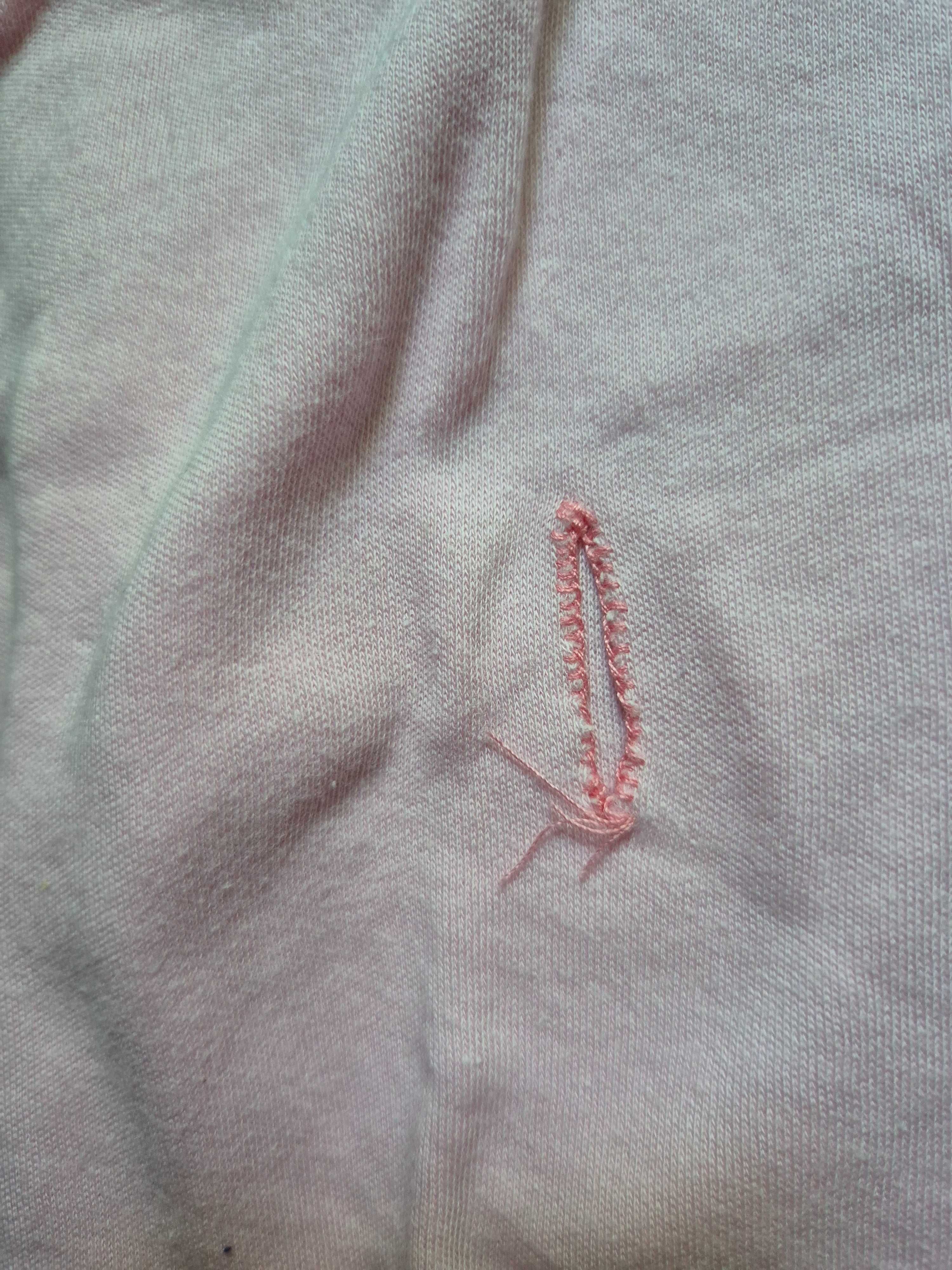 Body PEG/ gastrostomia r. 116