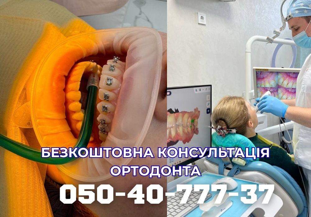 Ортодонт Полтава. Брекети, Елайнери. Безкоштовна Консультація.