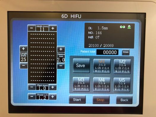 HIFU 6D SMAS аппарат 11 линий 1,5 3,0 4,5 + вагинальное омоложение