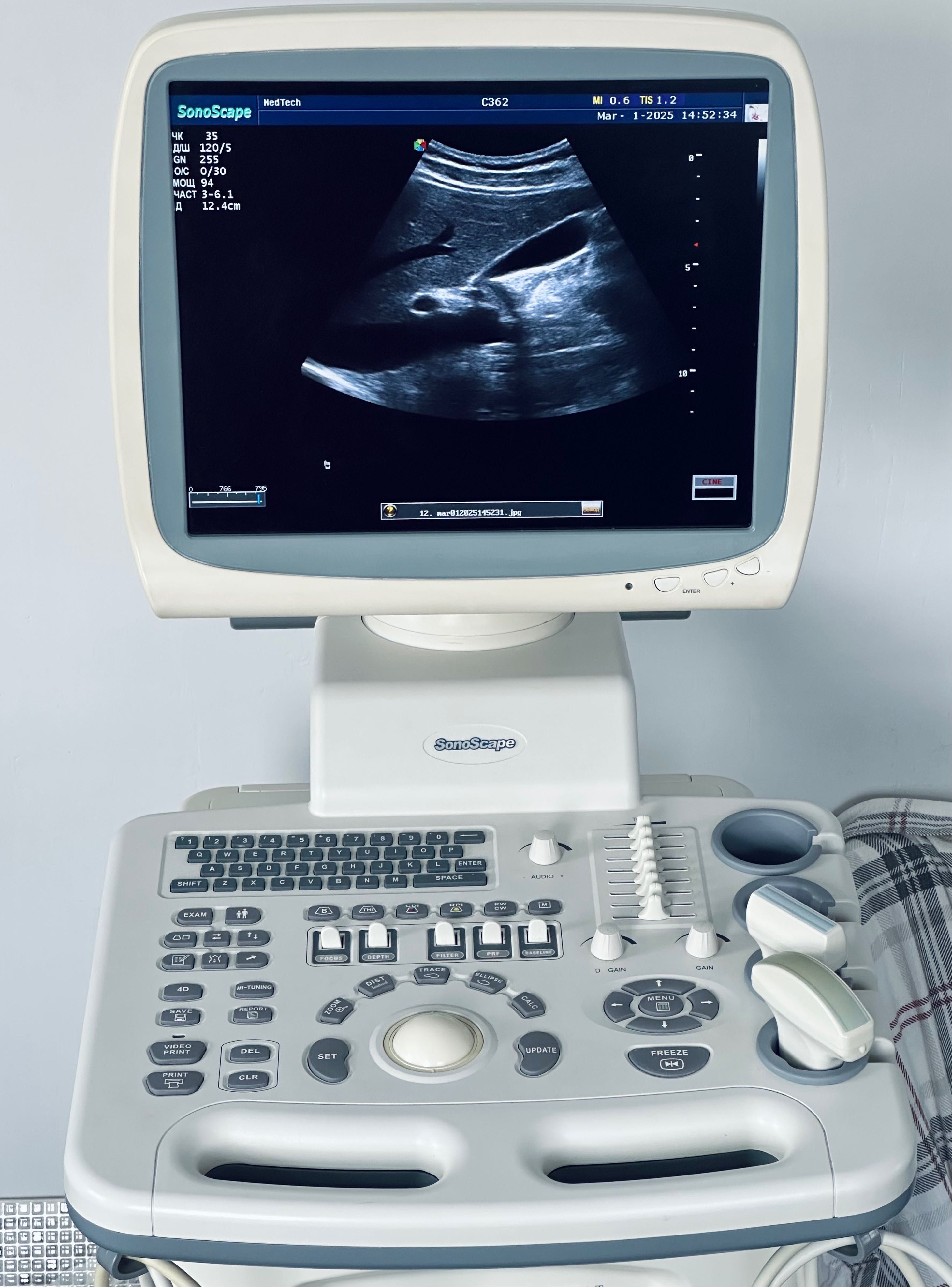 УЗД/УЗИ апарат Sonoscape SSI-6000 /Конвекс Лінійнійка
