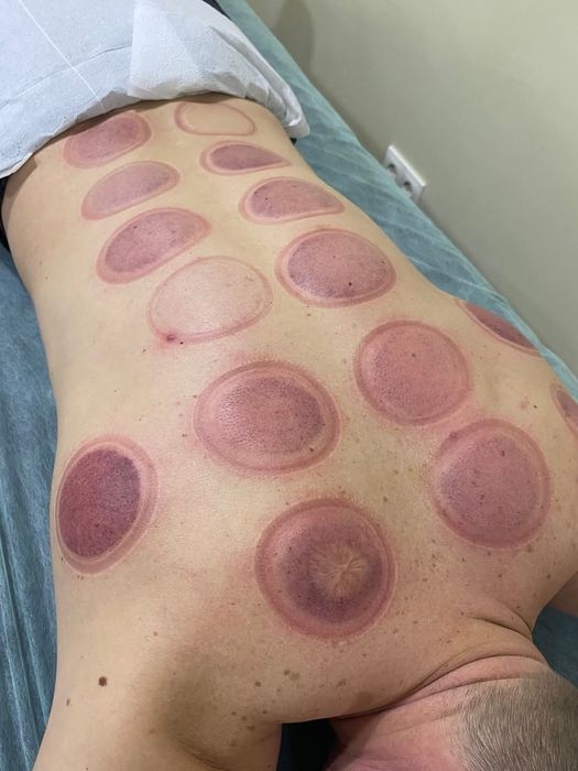 Масаж тіла/обличчя. Ендосфера