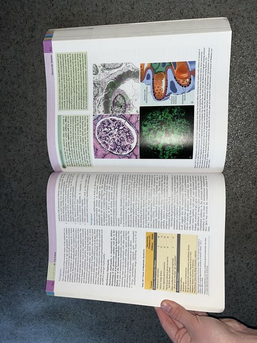 Атлас патології Pathologic basis of disease Robins and Cotran