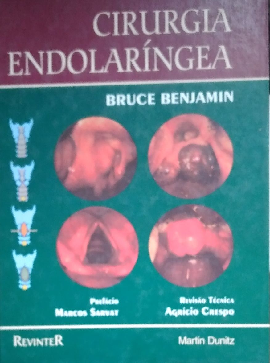 Cirurgia endolaríngea