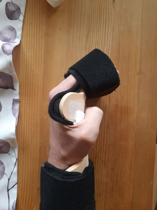 Stabilizator nadgartska dłoni palców