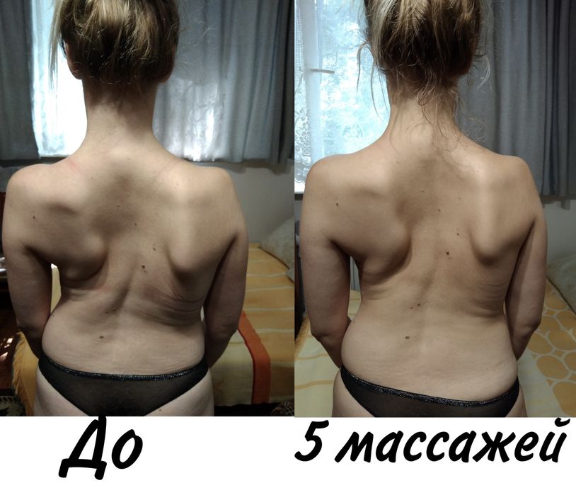 Костоправ. Масажист. Реабілітолог.Вісцеральний тарапевт. Масаж обличчя