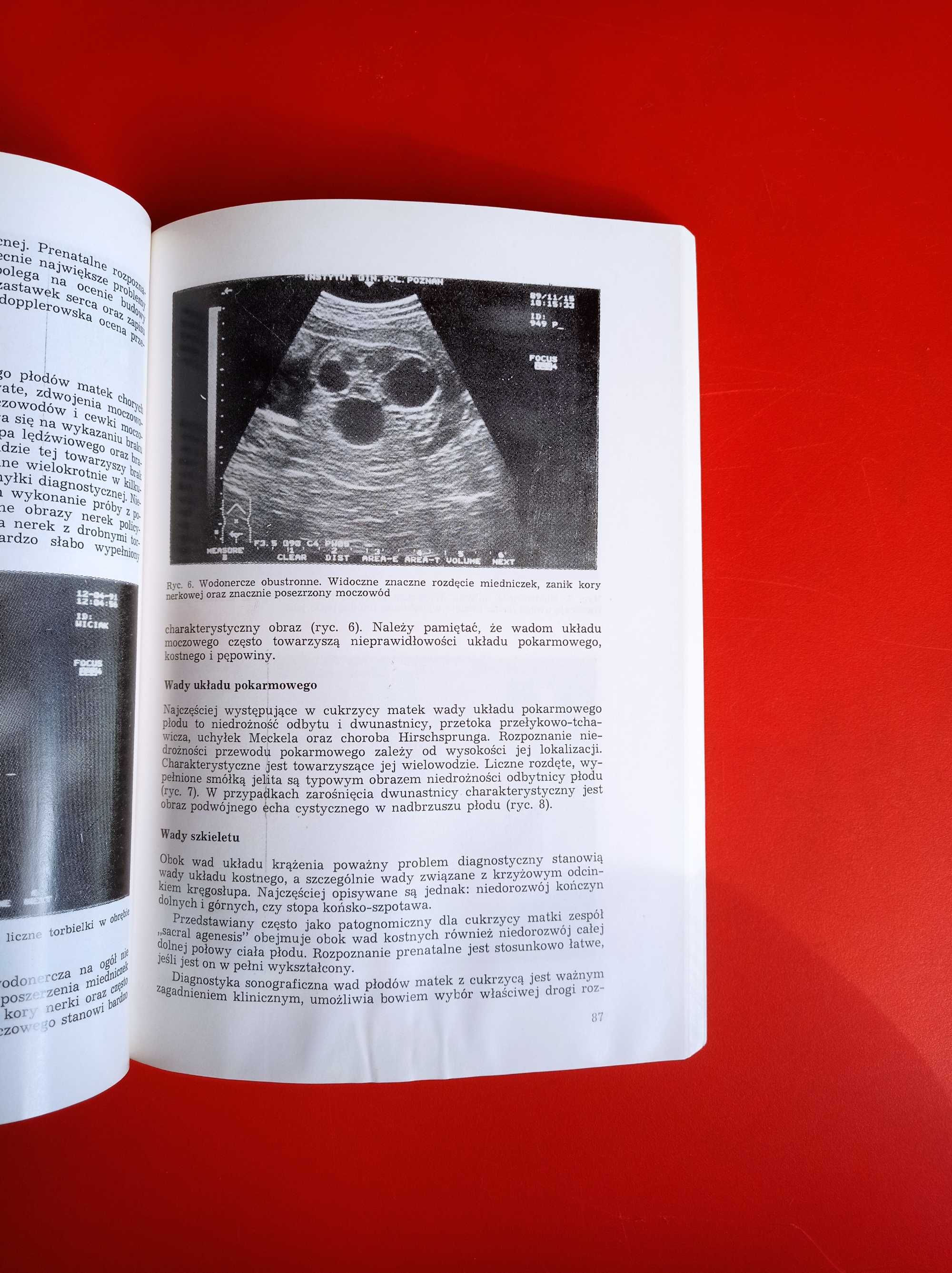 Kliniczna perinatologia i ginekologia, tom IX, Zbigniew Słomko