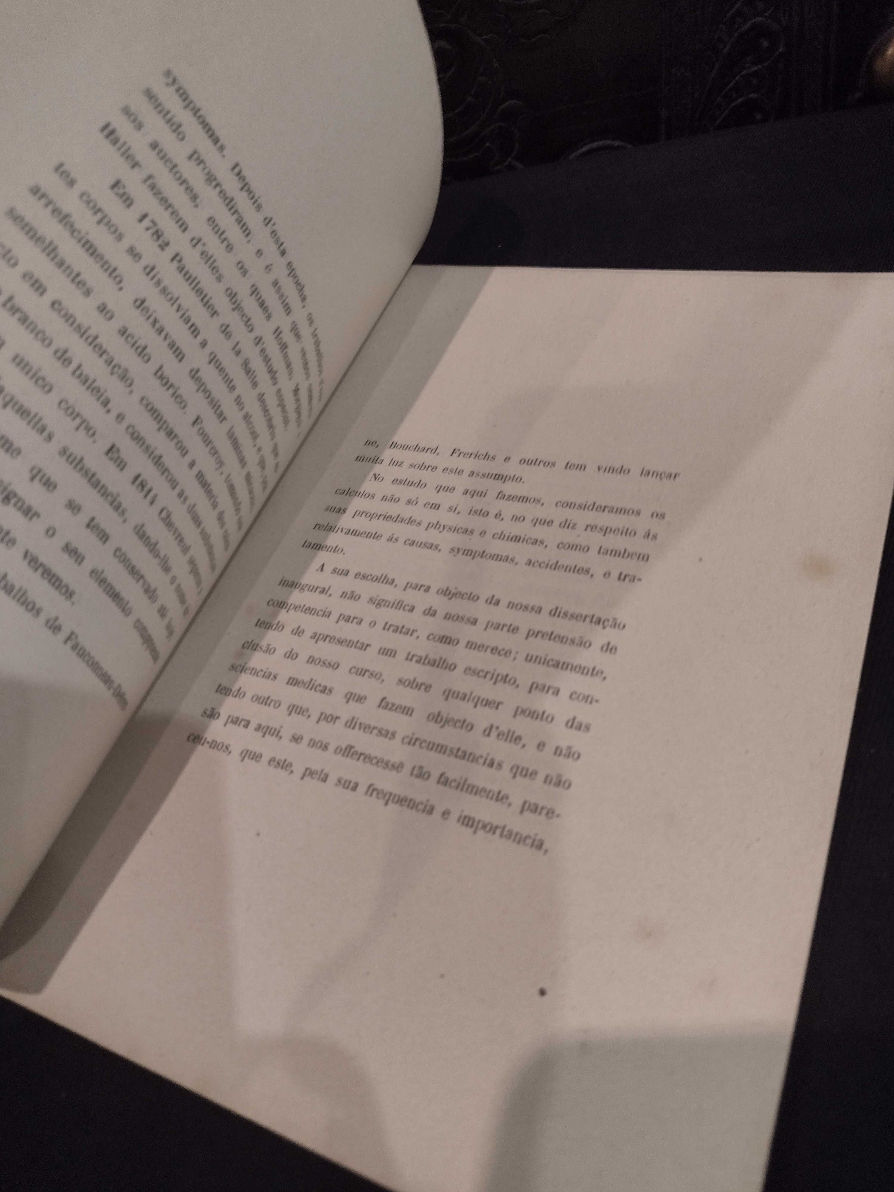 Os Cálculos Biliares 1888 Manoel dos Santos de Carvalho Júnior
