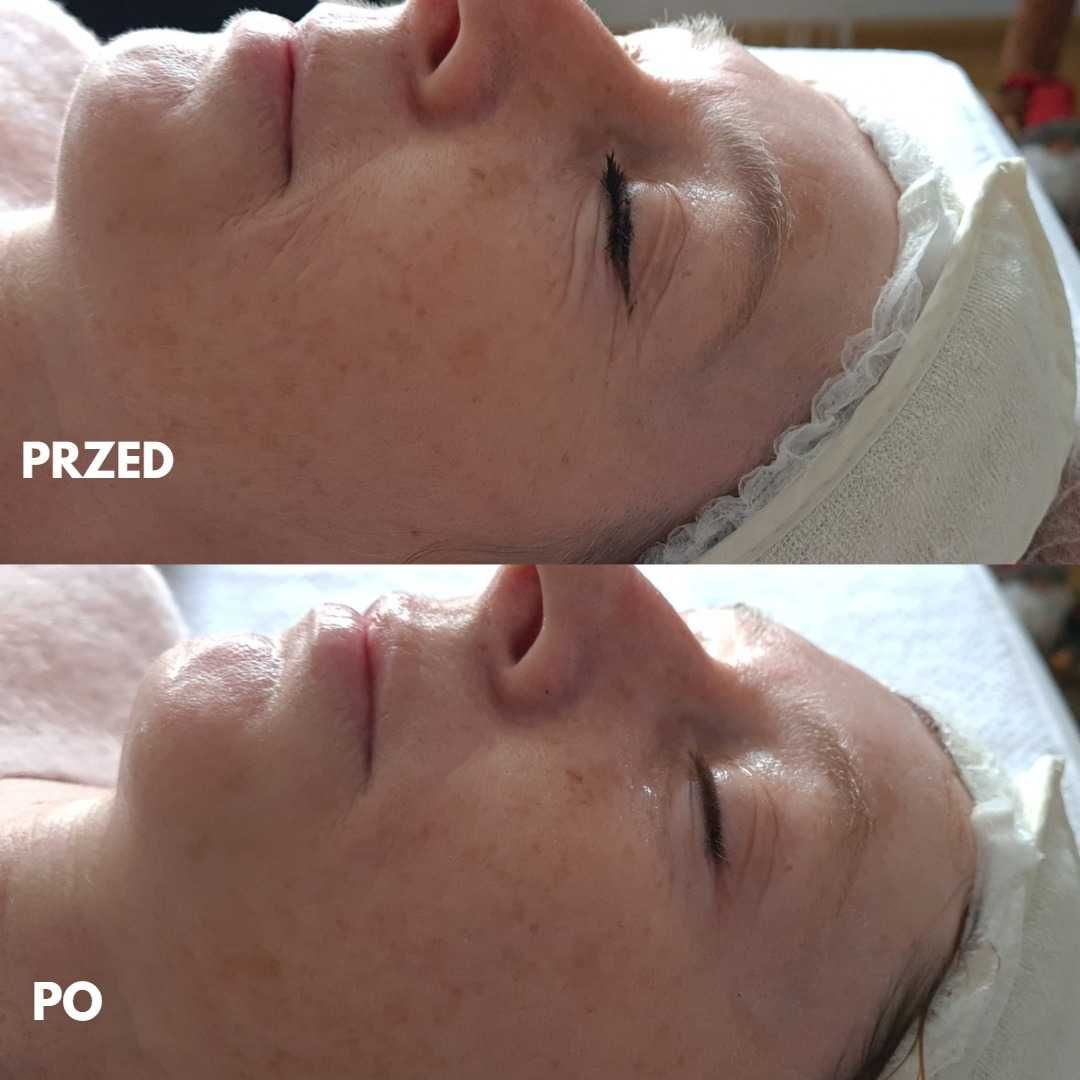 Maski ze złotem Souvre złote maski złoto koloidalne 3 szt lifting glow