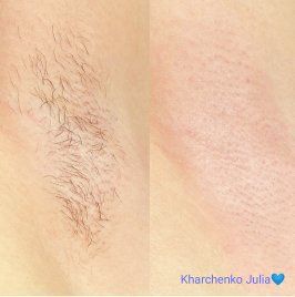 Шугаринг Депиляция воском, сахаром пос. Котовского/Амазонка