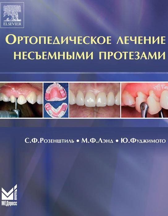 Розенштиль. Ортопедическое лечение несъёмными протезами (стоматология)