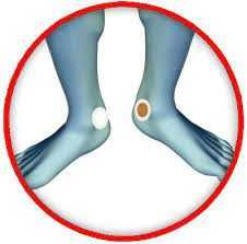 Energy Enhancer plastry bioelektrody LIFEWAVE