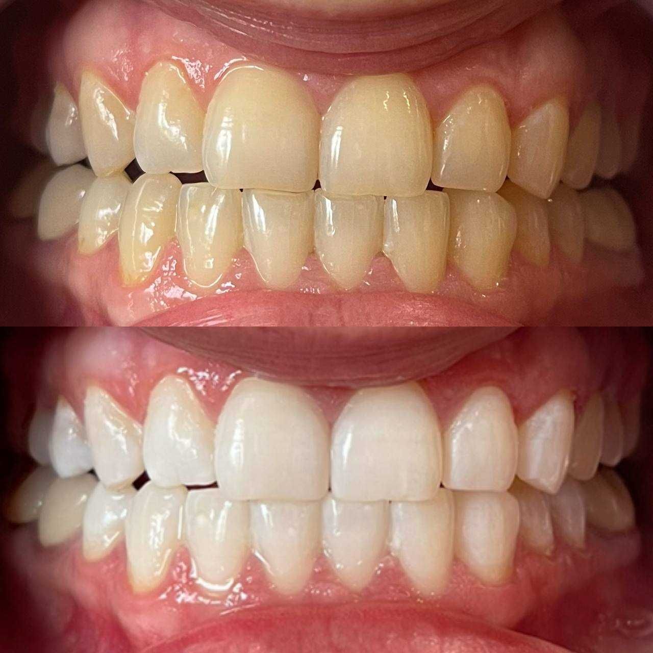 Косметичний бізнес / Франшиза відбілювання зубів Smile LAB