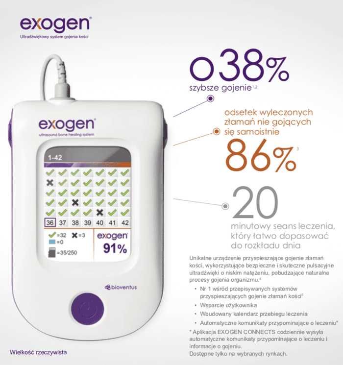 Wynajem Exogen - wspomaganie gojenia złamań ultradźwiękami
