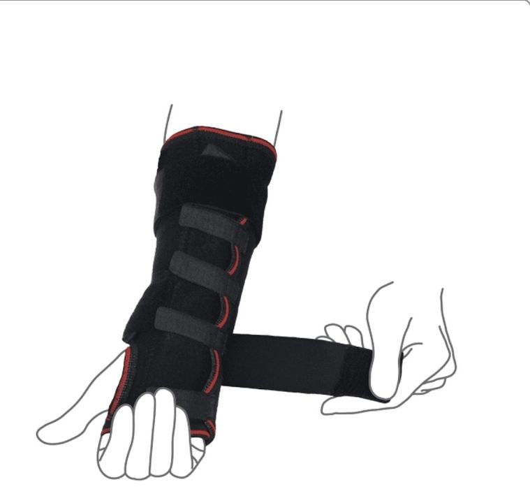 Шина на променево-зап'ястковий суглоб