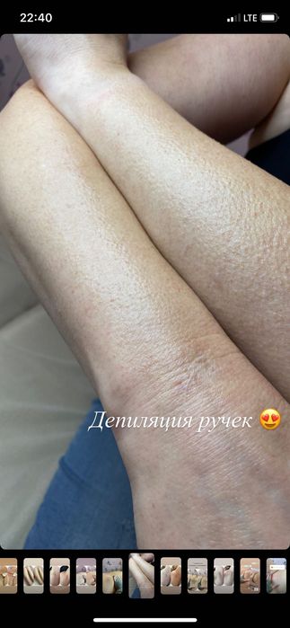 Воскова депіляція
