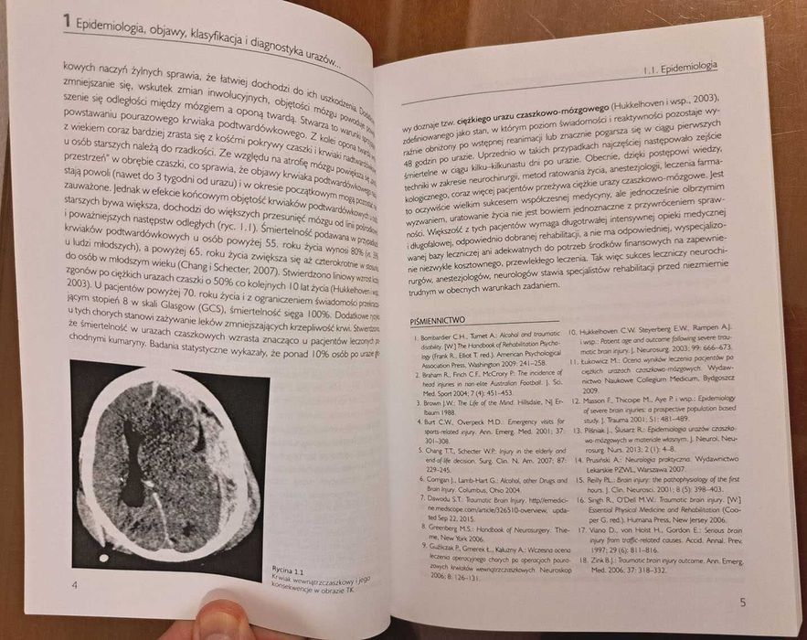 Nowa: "Urazy czaszkowo-mózgowe. Diagnostyka, leczenie, rehabilitacja"