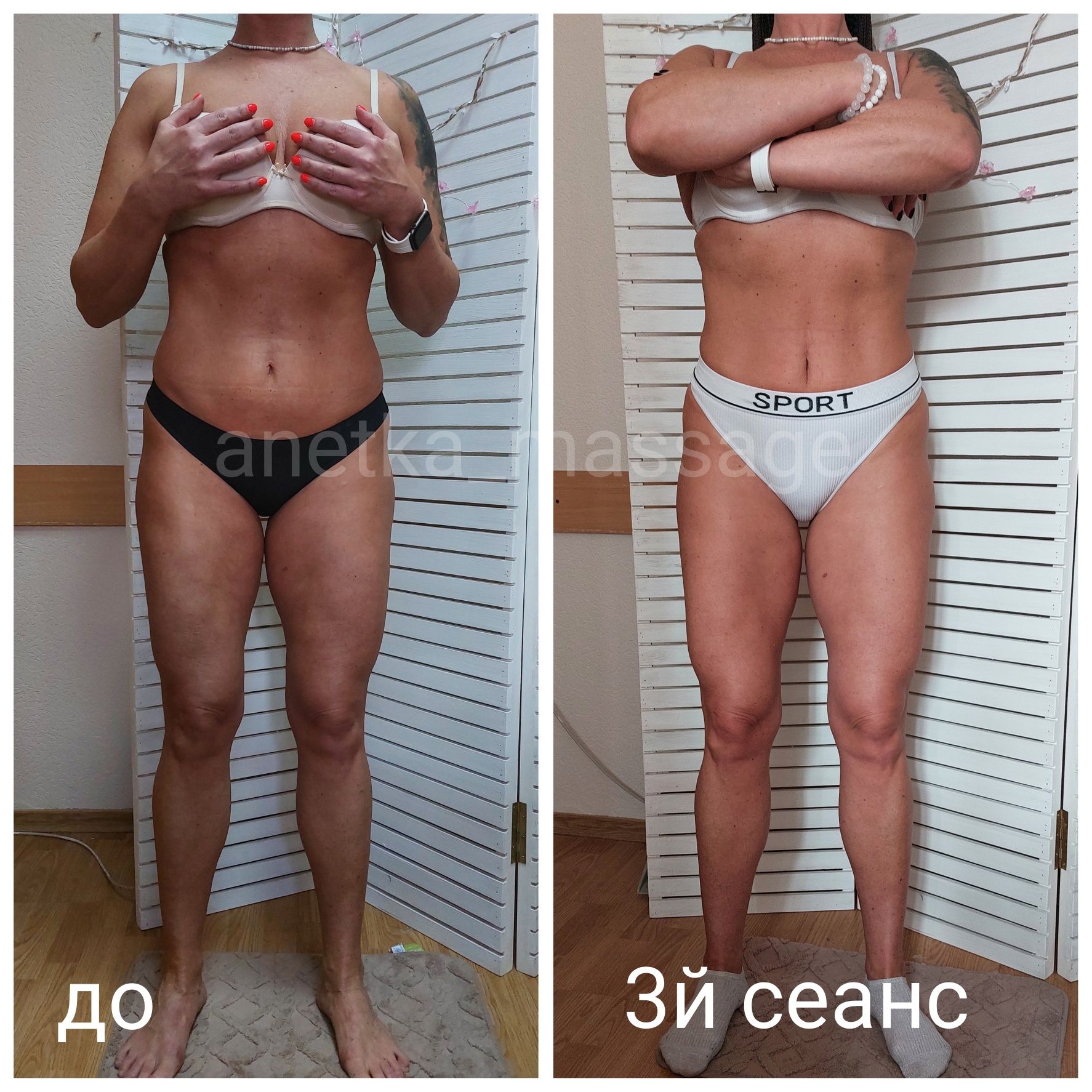 Массаж , антицеллюлитный массаж,  корекция фигуры, вакуумно-роликовый