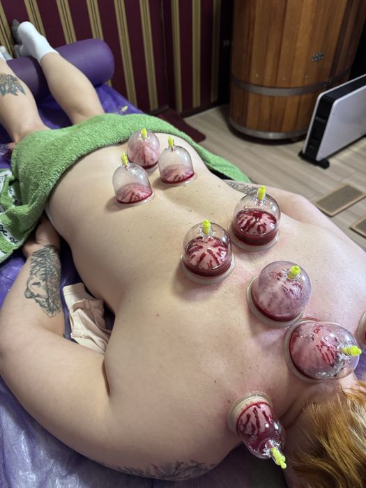 Ударно волновая экстракорпоральная радиальная терапия, аппарат 12 BAR