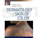 Dermatology for Skin of Color by A. Paul Kelly and Susan Taylor