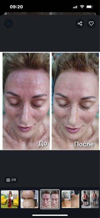 Масажист реабілітолог