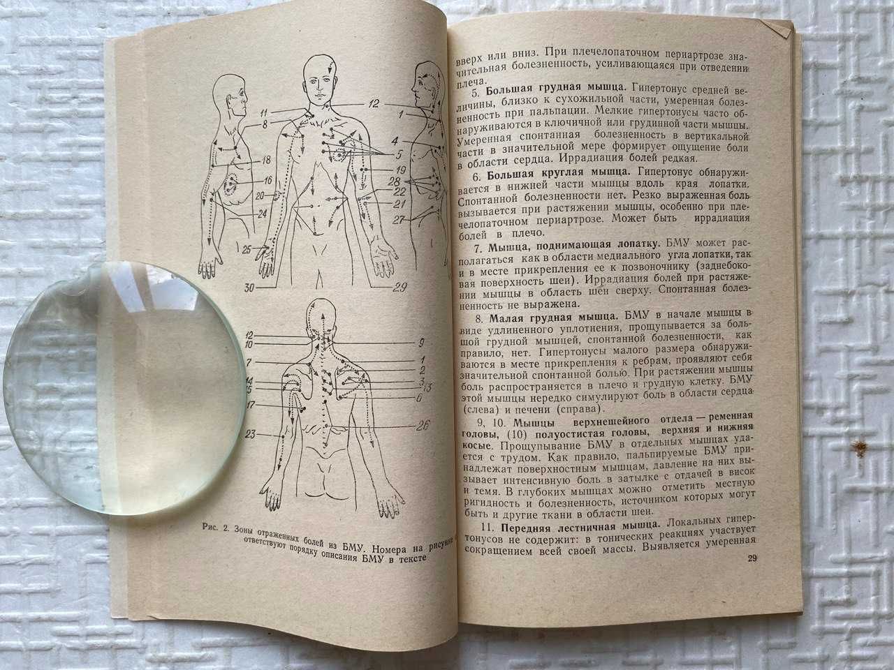 Болезненные мышечные уплотнения. Иваничев Г.А.