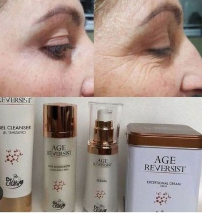 Эффект ботокса уже через 15 минут. Мгновенный результат.