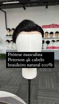 Protese capilar masculina