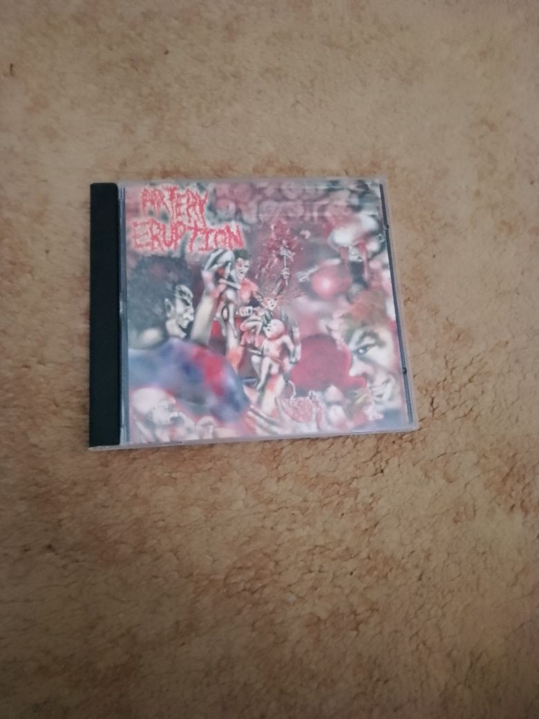 Cd artery eruption-gouging out eyes of mutilated infants.