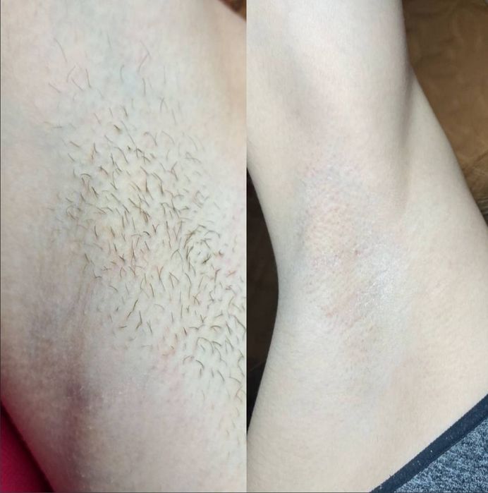 Шугаринг Кривий Ріг