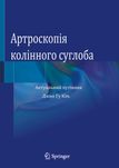 Артроскопія колінного суглоба. Актуальний путівник 2021 р.