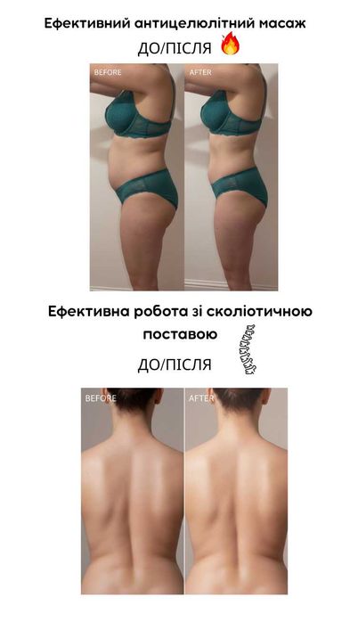 Масаж  Київ, масажист-реабілітолог, Голосіївський район