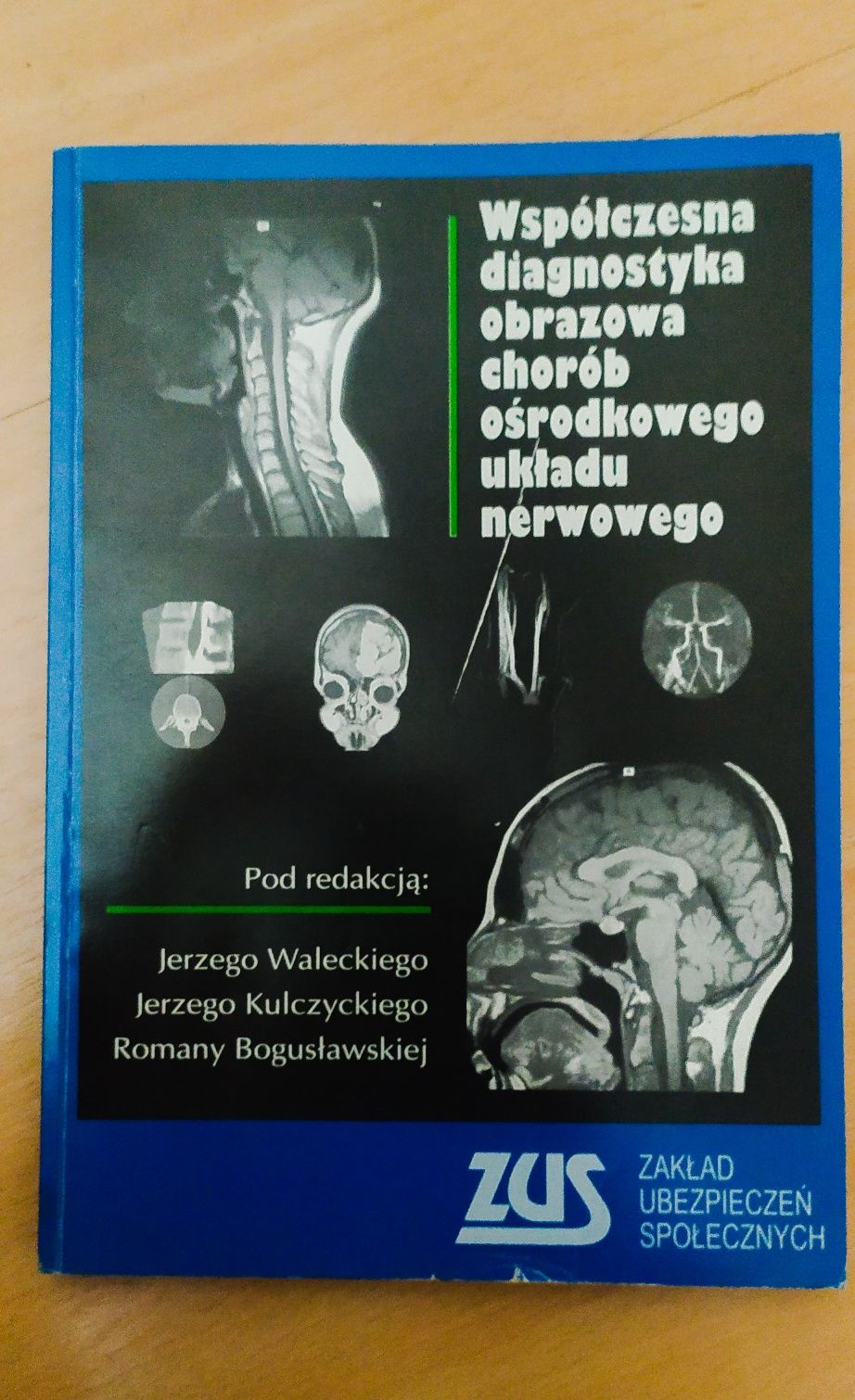 Współczesna diagnostyka obrazowa OUN