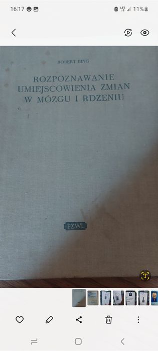 Rozpoznawanie umiejscowienia zmian w mózgu i rdzeniu
Bing Robert

Rok