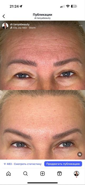 Косметолог, ботокс