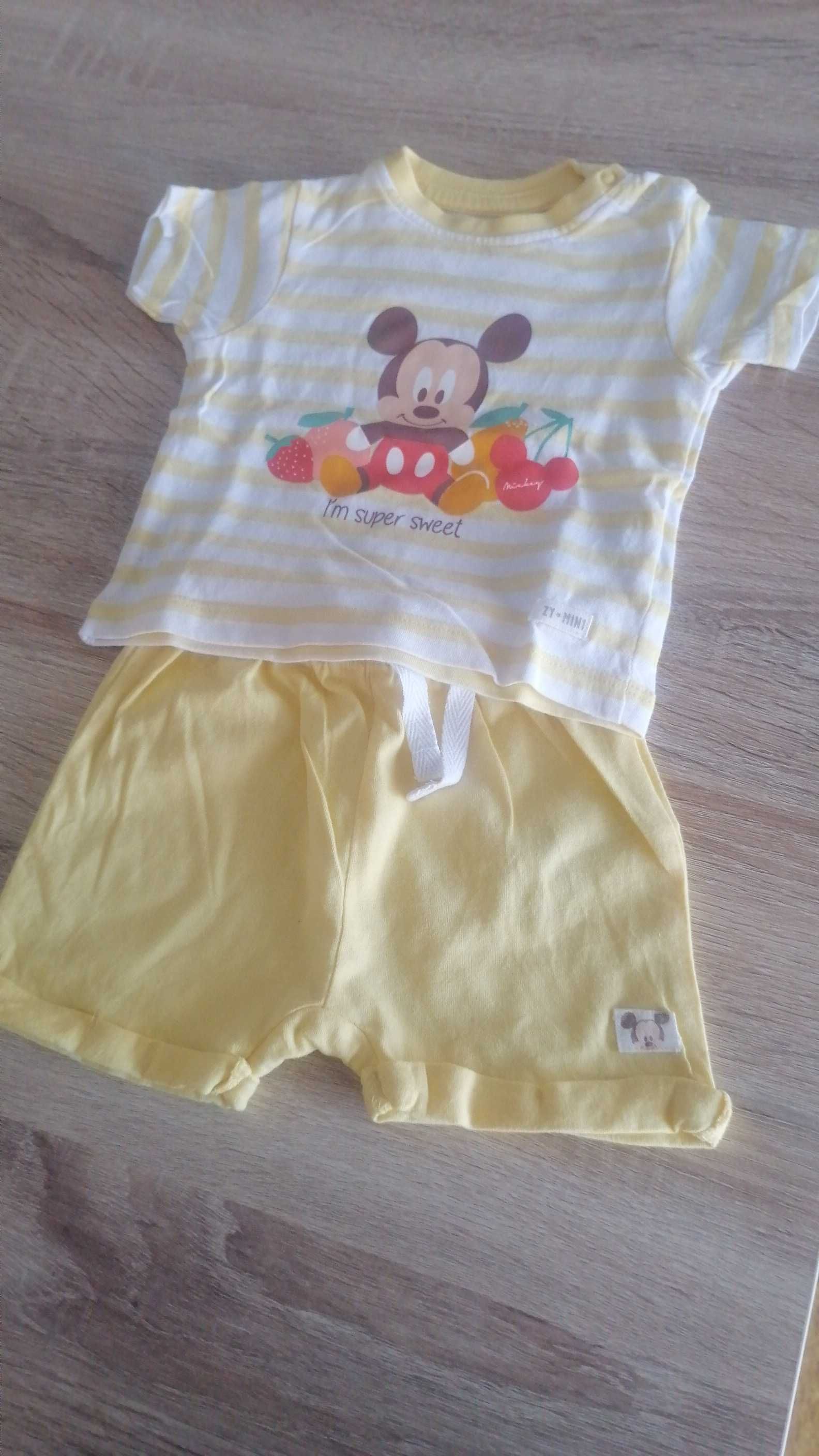 Conjunto Mickey zippy